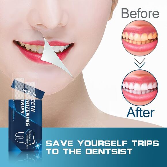 NEW 14PC Teeth Tooth Whitening Strips Sensitive Whitestrips 7 Fast Treatments - Picture 4 of 6
